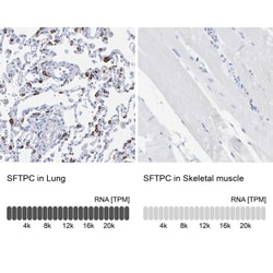 Prosurfactant Protein C Antibody, Novus Biologicals 0.1mL; Unlabeled:Antikörper